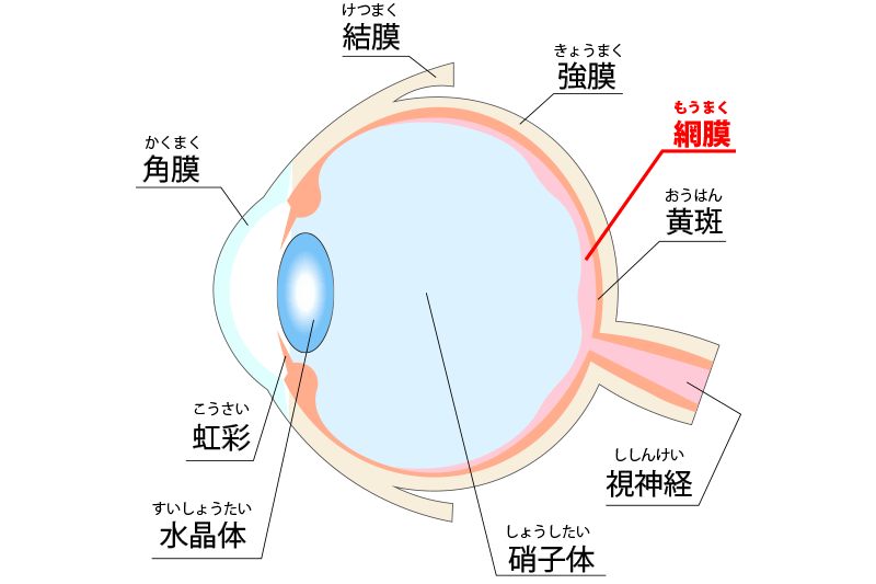 網膜光凝固術（レーザー治療）